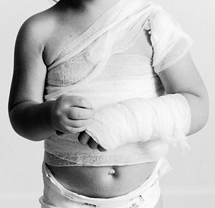 Image of child physical abuse from Time magazine